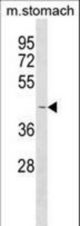 COLQ Antibody western blot of mouse stomach tissue lysates (35 ug/lane). The COLQ antibody detected the COLQ protein (arrow).