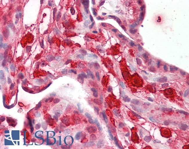 Human Placenta: Formalin-Fixed, Paraffin-Embedded (FFPE)
