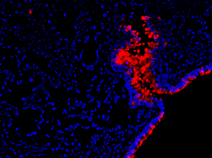 IHC of Fizz1 / RELM Alpha antibody LS-C104472