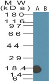 Western blot of fragilis in NIH 3T3 cell lysate in the (A) absence and (B) presence of immunizing peptide using antibody at1 ug/ml.