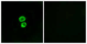 Immunofluorescence of MCF7 cells, using IFM3 Antibody. The picture on the right is treated with the synthesized peptide.