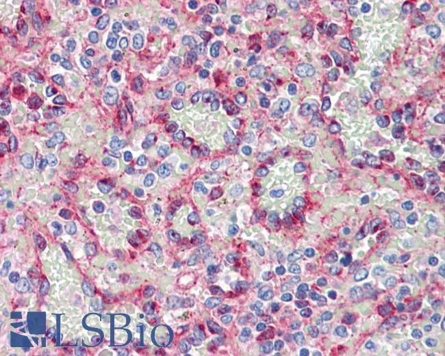 Anti-Fragilis / IFITM3 antibody IHC staining of human spleen. Immunohistochemistry of formalin-fixed, paraffin-embedded tissue after heat-induced antigen retrieval.