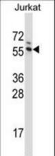 G3BP1 Antibody western blot of Jurkat cell line lysates (35 ug/lane). The G3BP1 antibody detected the G3BP1 protein (arrow).