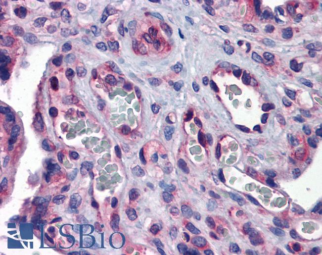 Anti-G3BP1 / G3BP antibody IHC of human placenta. Immunohistochemistry of formalin-fixed, paraffin-embedded tissue after heat-induced antigen retrieval. Antibody LS-B5637 concentration 5 ug/ml.
