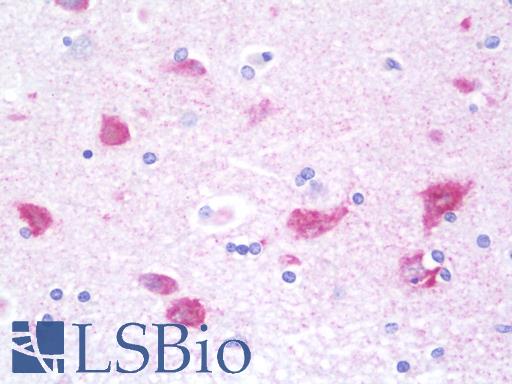 Anti-G3BP2 antibody IHC staining of human brain, cortex. Immunohistochemistry of formalin-fixed, paraffin-embedded tissue after heat-induced antigen retrieval. Antibody LS-B9861 concentration 10 ug/ml.