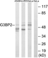 Western blot of extracts from HeLa/HUVEC/A549 cells, using G3BP2 Antibody. The lane on the right is treated with the synthesized peptide.