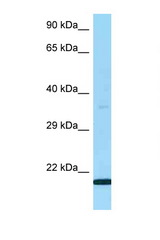 LY6G5B antibody LS-C146225 Western blot of Fetal Lung lysate. Antibody concentration 1 ug/ml.