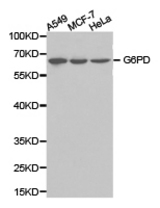 Western blot of extracts of various cell lines, using G6PD antibody.