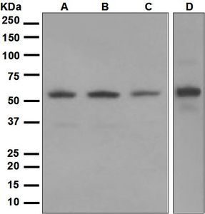 Western blot analysis on (A) 293T, (B) Molt-4, (C) HUVEC, and (D) HeLa cell lysates using anti-G6PD antibody.