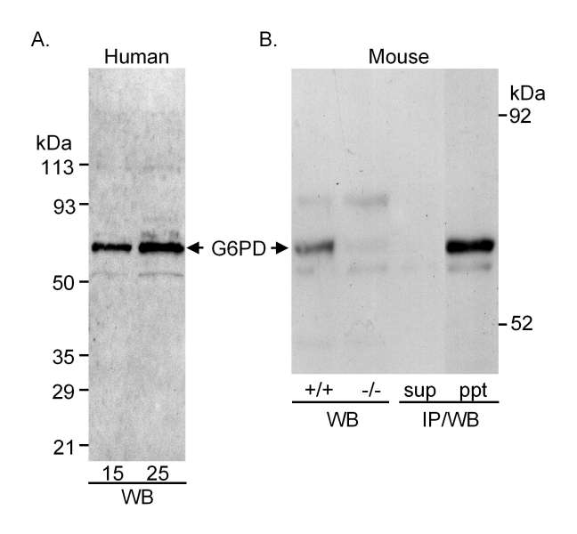 Detection of Human and Mouse G6PD by Western Blot and Immunoprecipitation. Samples: Whole cell lysate (15 or 25 ug for human; 20 ug for mouse WB; 1 mg for mouse IP/WB) from human umbilical vein endothelial cells or mouse peritoneal macrophages from wild type or G6PD deficient mice. Antibody: Affinity purified rabbit anti-G6PD used at 0.6 ug/ml (A) and 0.5 ug/ml (B) for WB or 3.75 ug/mg lysate for IP (B). Detection: Chemiluminescence.