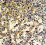 G6PD Antibody IHC of formalin-fixed and paraffin-embedded testis followed by peroxidase-conjugated secondary antibody and DAB staining.