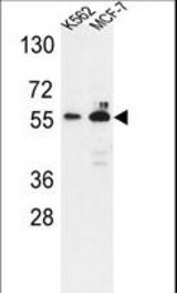Western blot of G6PD Antibody in K562,MCF-7 cell line lysates (35 ug/lane). G6PD (arrow) was detected using the purified antibody.