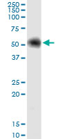 G6PD monoclonal antibody (M01), clone 3H5. Western Blot analysis of G6PD expression in human kidney.