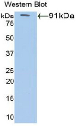 Western blot of recombinant G6PD.