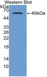Western blot of recombinant G6PD.