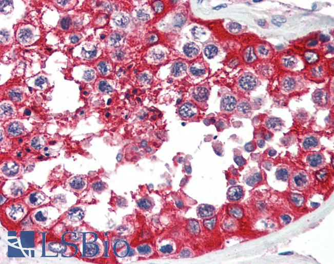 Anti-G6PD antibody IHC of human testis. Immunohistochemistry of formalin-fixed, paraffin-embedded tissue after heat-induced antigen retrieval. Antibody LS-B3253 concentration 5 ug/ml.