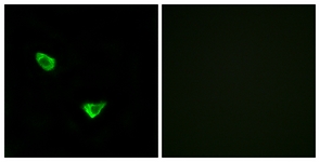 Immunofluorescence of MCF7 cells, using CHSY2 Antibody. The sample on the right was incubated with synthetic peptide.