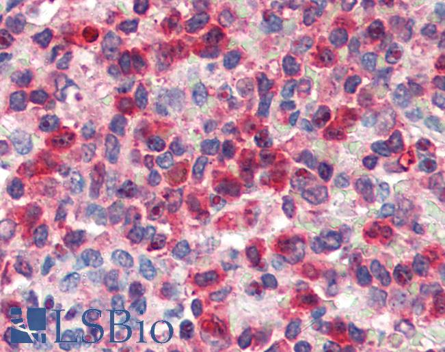 Anti-G6PD antibody IHC of human spleen. Immunohistochemistry of formalin-fixed, paraffin-embedded tissue after heat-induced antigen retrieval. Antibody LS-B3253 concentration 5 ug/ml.