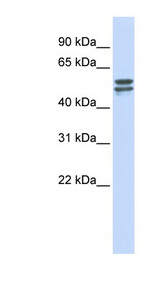 G6PD antibody LS-C112198 Western blot of MCF7 cell lysate.