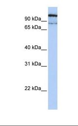 MCF7 cell lysate. Antibody concentration: 1.0 ug/ml. Gel concentration: 12%.