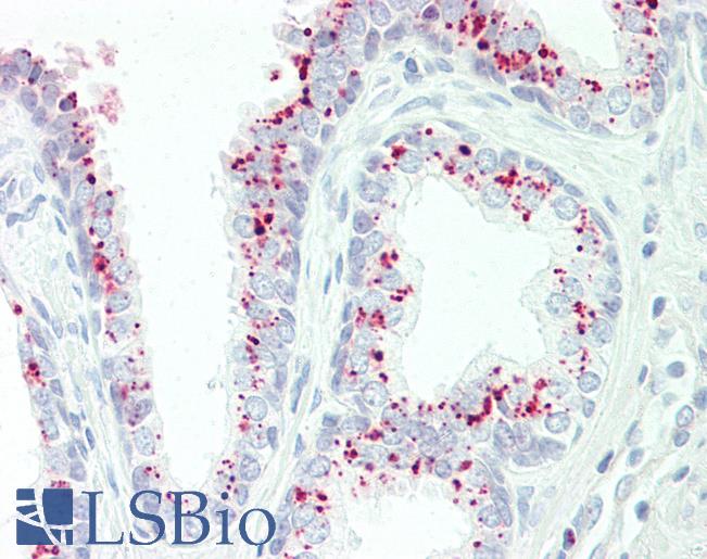 Anti-GAA antibody IHC staining of human prostate. Immunohistochemistry of formalin-fixed, paraffin-embedded tissue after heat-induced antigen retrieval. Antibody LS-B10678 dilution 1:50.