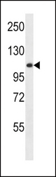 GAA Antibody western blot of HL-60 cell line lysates (35 ug/lane). The GAA antibody detected the GAA protein (arrow).
