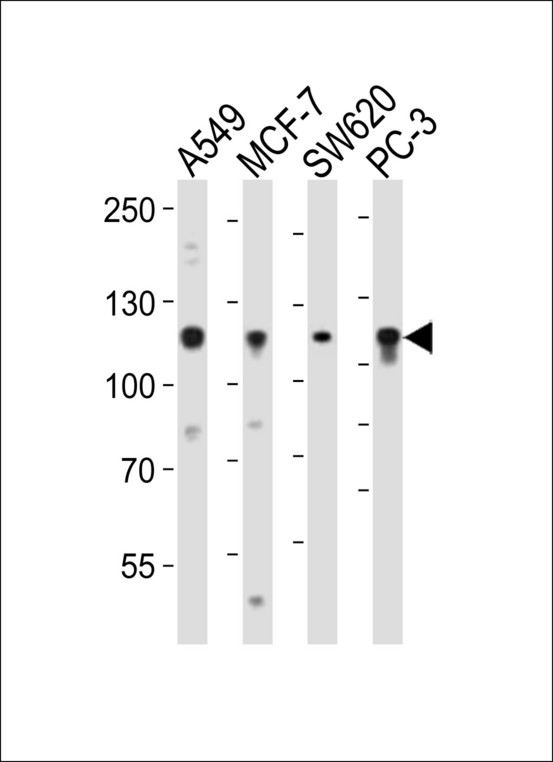 Western blot of lysates from A549, MCF-7, SW620, PC-3 cell line (from left to right), using GAA Antibody. Antibody was diluted at 1:1000 at each lane. A goat anti-rabbit IgG H&L (HRP) at 1:10000 dilution was used as the secondary antibody. Lysates at 20ug per lane.