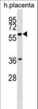 GAB3 Antibody western blot of human placenta tissue lysates (35 ug/lane). The GAB3 antibody detected the GAB3 protein (arrow).