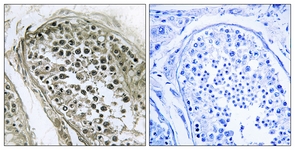 IHC of paraffin-embedded human esophagus, using GAB4 Antibody. The picture on the right is treated with the synthesized peptide.