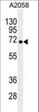 GAB4 Antibody western blot of A2058 cell line lysates (35 ug/lane). The GAB4 antibody detected the GAB4 protein (arrow).