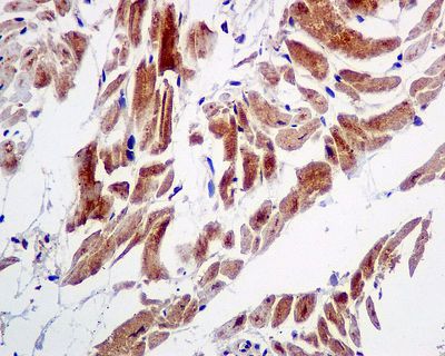 IHC of paraffin-embedded human heart tissue using anti-GABARAP antibody.