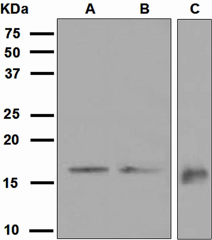 Western blot analysis on (A) fetal brain, (B) SH-SY5Y, and (C) Flag-GABARAP recombinant protein lysates using anti-GABARAP antibody.