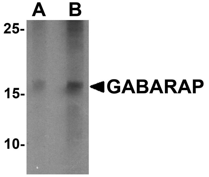 Western blot analysis of GABARAP in K562 cell lysate with GABARAP antibody at (A) 1 and (B) 2 ug/ml.