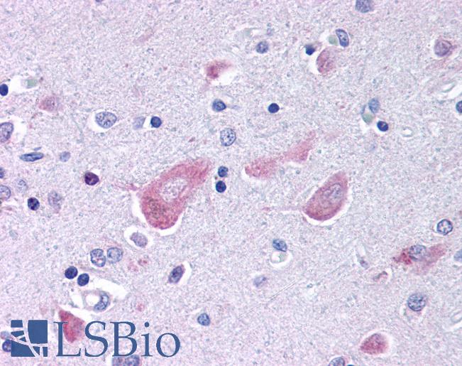 Anti-GABARAP antibody IHC of human brain, cortex. Immunohistochemistry of formalin-fixed, paraffin-embedded tissue after heat-induced antigen retrieval. Antibody LS-B283 concentration 5 ug/ml.