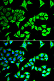Immunofluorescence analysis of MCF-7 cell using GABARAP antibody. Blue: DAPI for nuclear staining.