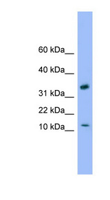 GABARAP antibody LS-C117081 Western blot of Fetal Heart lysate.