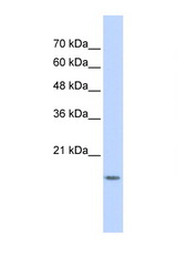 GABARAPL1 antibody LS-C102630 Western blot of 293T Cell lysate. Antibody concentration 1 ug/ml.