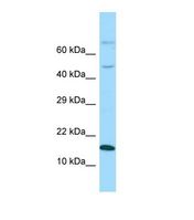 Western blot of Human Fetal Brain. GABARAPL1 antibody dilution 1.0 ug/ml.