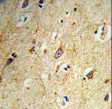 Formalin-fixed and paraffin-embedded human brain tissue reacted with GABARAPL1 Antibody, which was peroxidase-conjugated to the secondary antibody, followed by DAB staining. This data demonstrates the use of this antibody for immunohistochemistry; clinical relevance has not been evaluated.