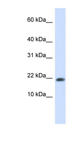 GABARAPL2 antibody LS-C102420 Western blot of 293T cell lysate.