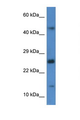 GABARAPL2 antibody LS-C135276 Western blot of Rat Brain lysate. Antibody concentration 1 ug/ml.