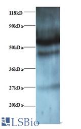 Western blot of Gamma-aminobutyric acid receptor-associated protein-like 2 antibody at 2 ug/ml + EC109whole cell lysate. Secondary: Goat polyclonal to Rabbit IgG at 1:15000 dilution. Predicted band size: 13 kDa. Observed band size: 60 kDa.