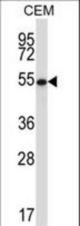 GABPA Antibody western blot of CEM cell line lysates (35 ug/lane). The GABPA antibody detected the GABPA protein (arrow).