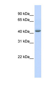 GABPB2 antibody LS-C109578 Western blot of HeLa lysate.