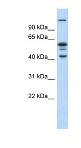 GABPB2 antibody LS-C82049 Western blot of Fetal Muscle lysate.