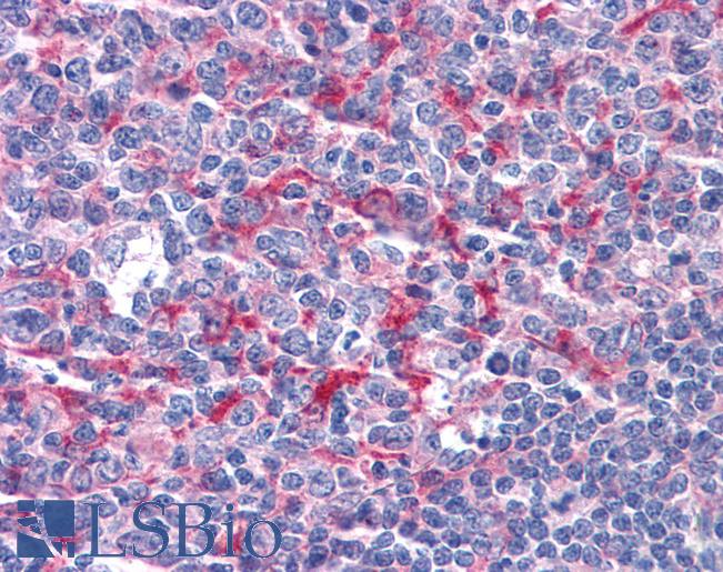 Anti-GABPB1 antibody IHC of human tonsil. Immunohistochemistry of formalin-fixed, paraffin-embedded tissue after heat-induced antigen retrieval. Antibody LS-B4349 concentration 3.75 ug/ml.