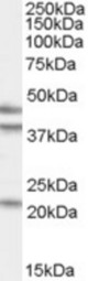 Antibody (0.5 ug/ml) staining of HeLa cell lysate (35 ug protein in RIPA buffer). Primary incubation was 1 hour. Detected by chemiluminescence.