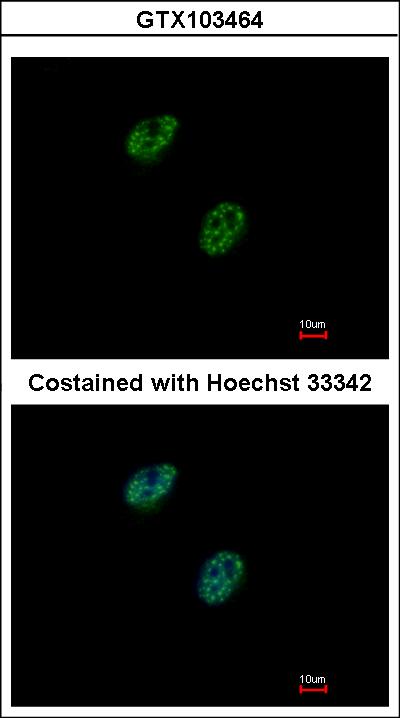 Immunofluorescence of paraformaldehyde-fixed HeLa using GABPB1 antibody at 1:500 dilution.