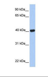 Fetal heart lysate. Antibody concentration: 1.0 ug/ml. Gel concentration: 12%.