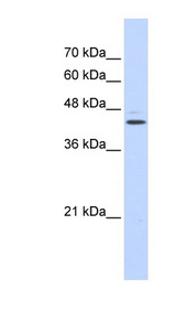GABPB2 antibody LS-C102728 Western blot of Transfected 293T cell lysate.